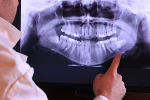 Best Emergency Tooth Extraction in Euless, TX