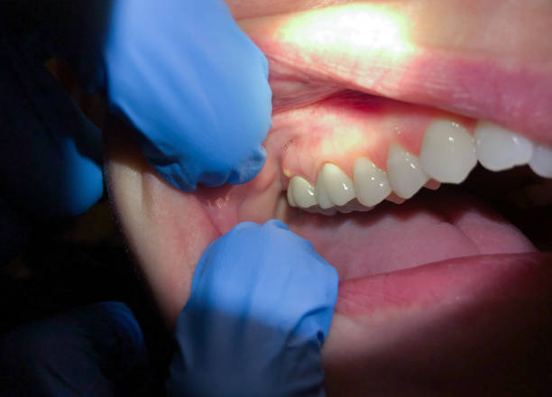 Best Emergency TMJ Treatment in Euless, TX