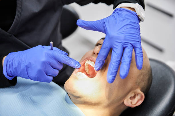 Best Emergency Dental Care for Broken or Chipped Teeth in Euless, TX